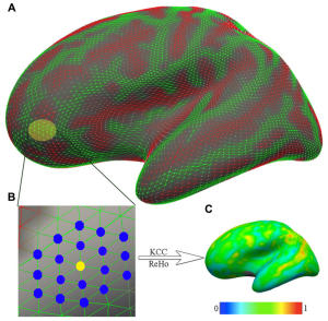 Brain and functional homogeneity, research article